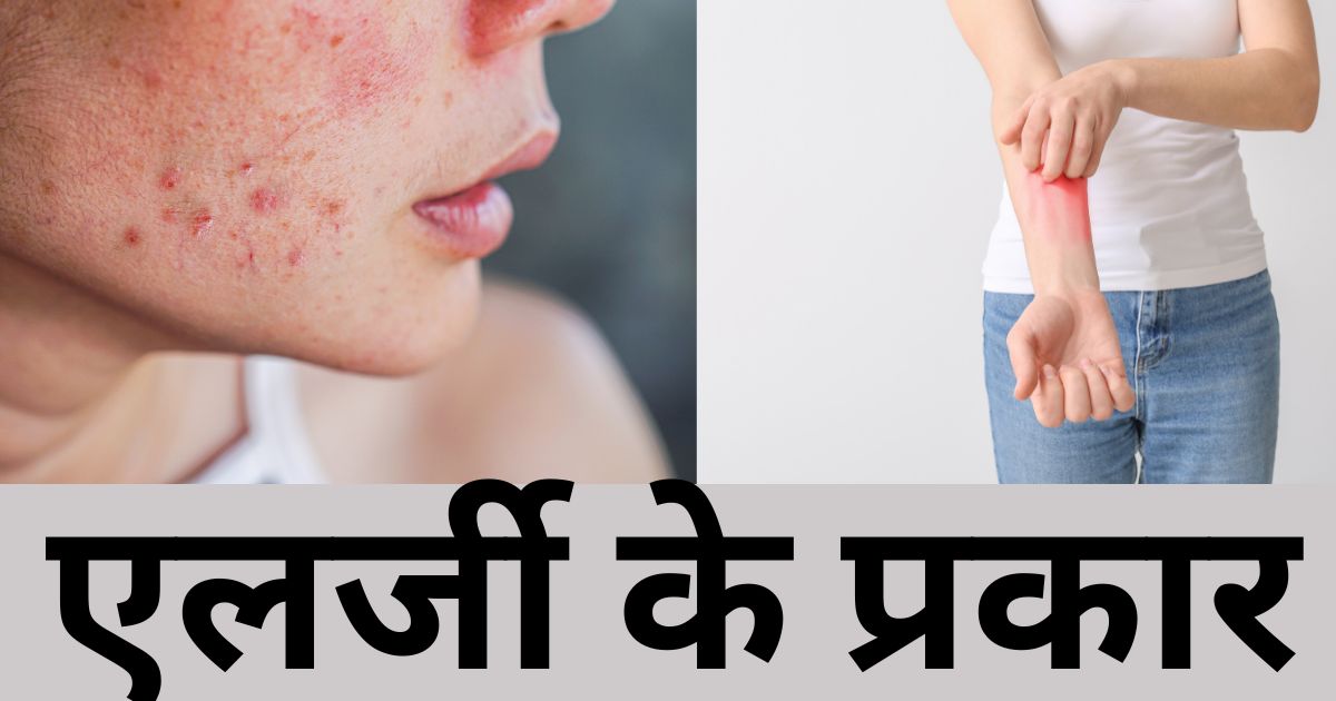 Types of allergies in hindi